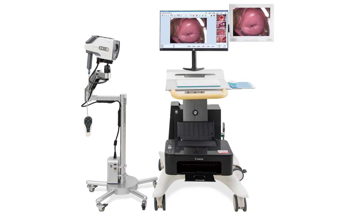 如何選擇數(shù)碼電子陰道鏡？