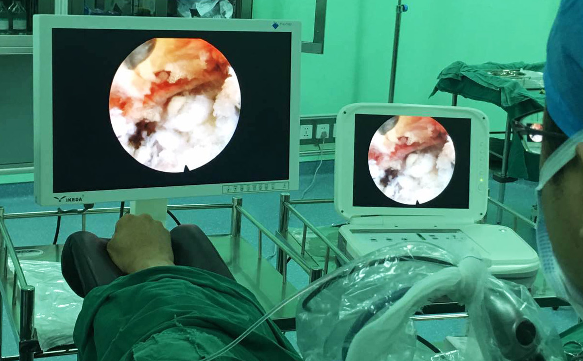 如何維護(hù)保養(yǎng)內(nèi)窺鏡顯示器？