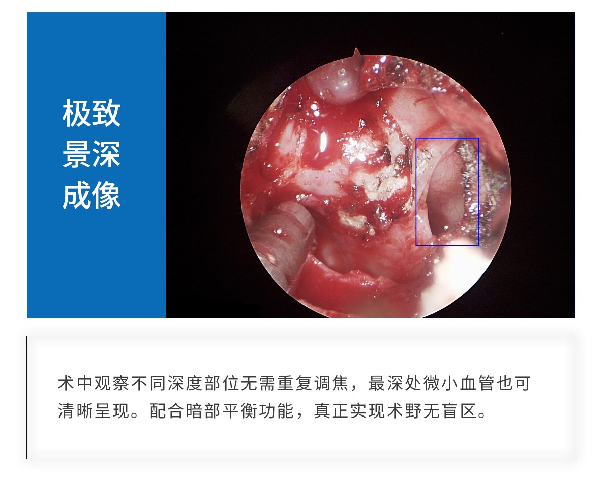 【4K醫(yī)用內(nèi)窺鏡攝像系統(tǒng)】您的第一臺“4K”找到了嗎？