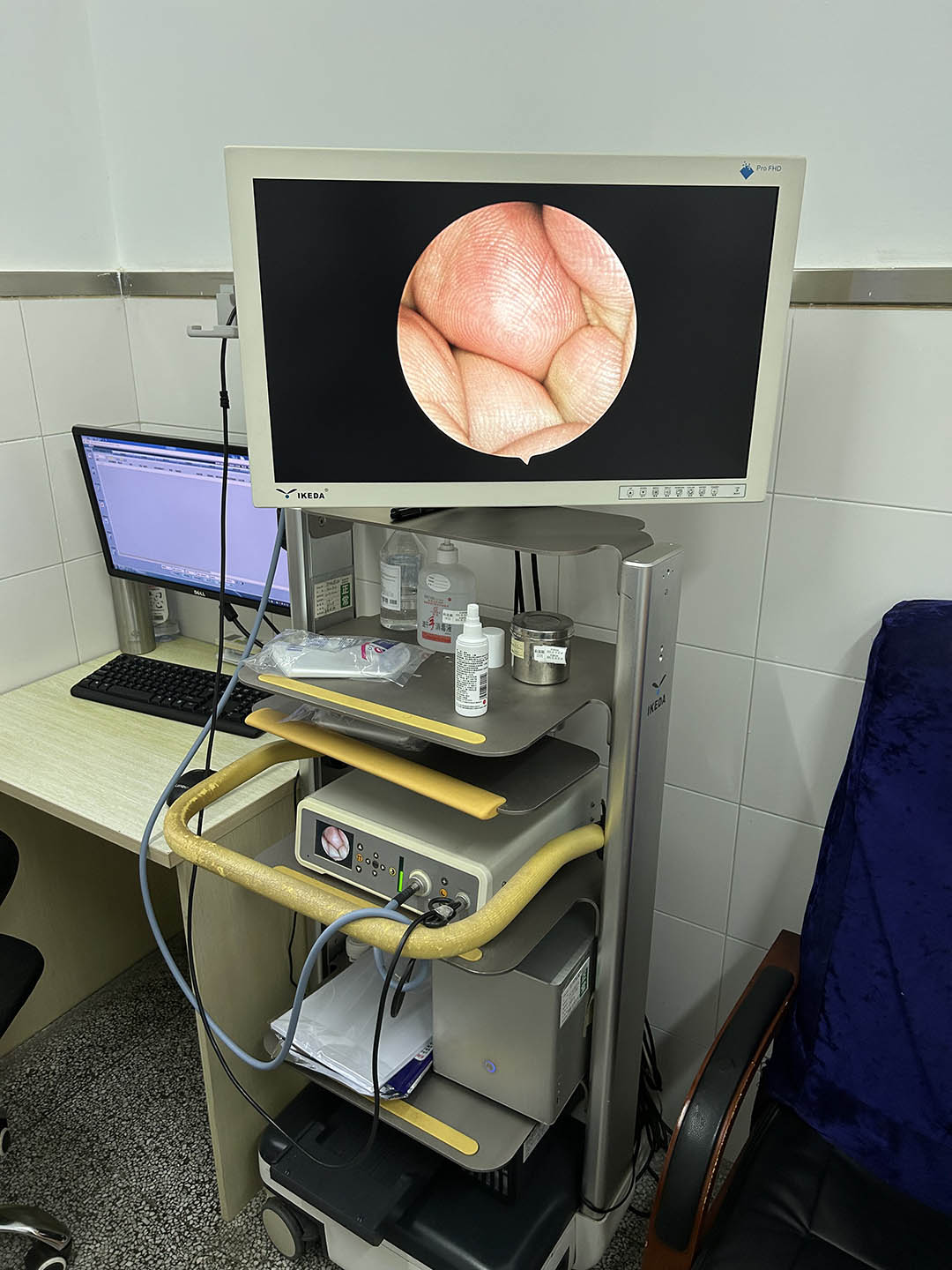 醫(yī)用內窺鏡攝像系統(tǒng)