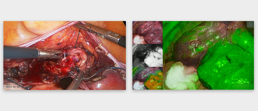 4K熒光內(nèi)窺鏡攝像系統(tǒng)