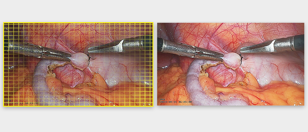 4K熒光內(nèi)窺鏡攝像系統(tǒng)