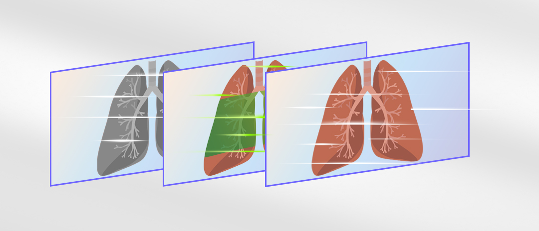 4K熒光內(nèi)窺鏡攝像系統(tǒng)
