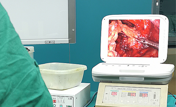 內(nèi)窺鏡攝像機(jī)哪個好？