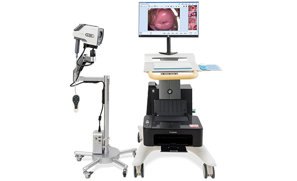 電子陰道鏡鏡頭哪家好？