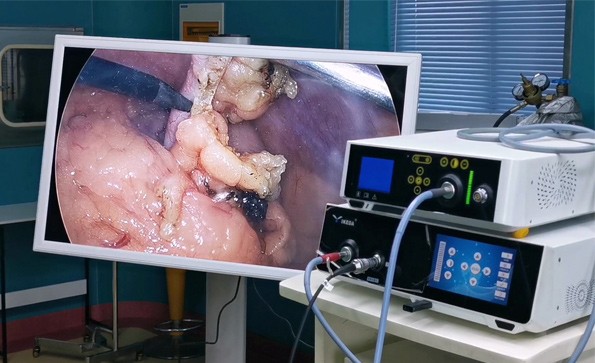 宮、腹腔鏡聯(lián)合手術(shù)在婦科的應(yīng)用