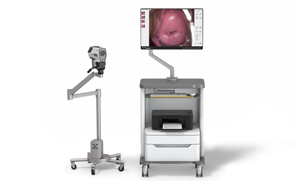 為什么陰道鏡檢查要用醋酸溶液和碘？