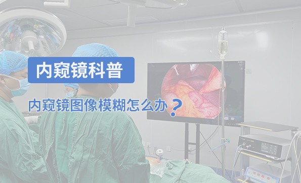 內(nèi)窺鏡科普：內(nèi)窺鏡圖像模糊怎么辦？