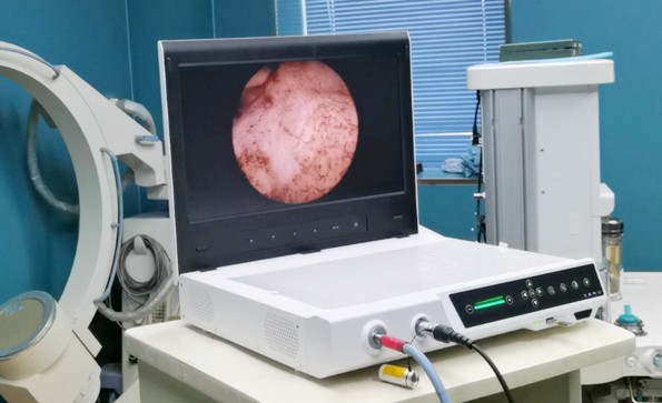 一文了解關節(jié)鏡系統的構成、應用、操作流程