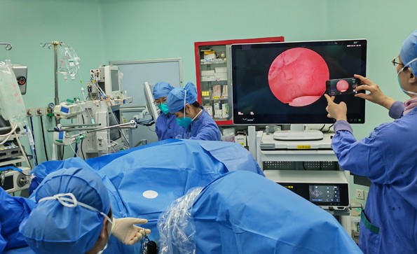 宮腔鏡系統的工作原理及未來發(fā)展方向